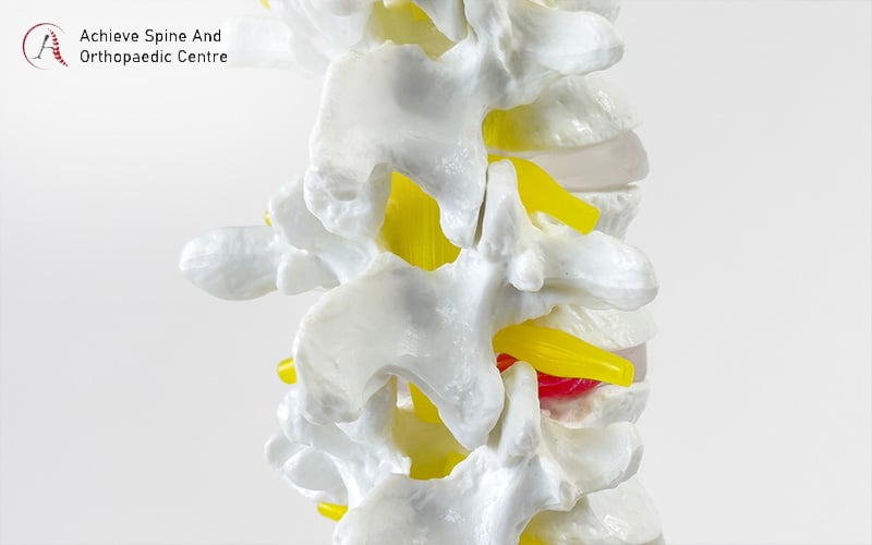 How the spine deteriorates as we age