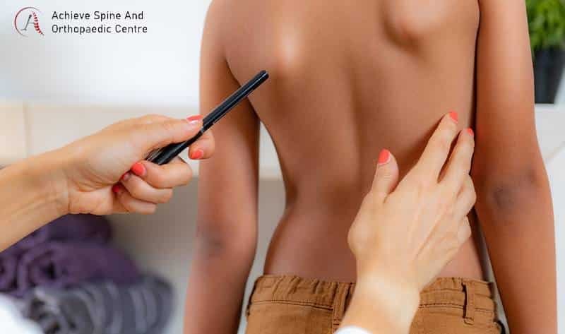 Doctor diagnosing severity of curving.