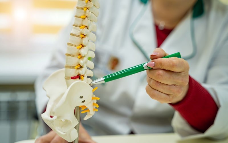Doctor pointing to spine model explaining adjacent segment degeneration.